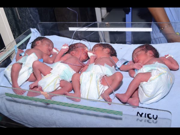 సిజేరియన్ ఆపరేషన్ సిజేరియన్ ఆపరేషన్