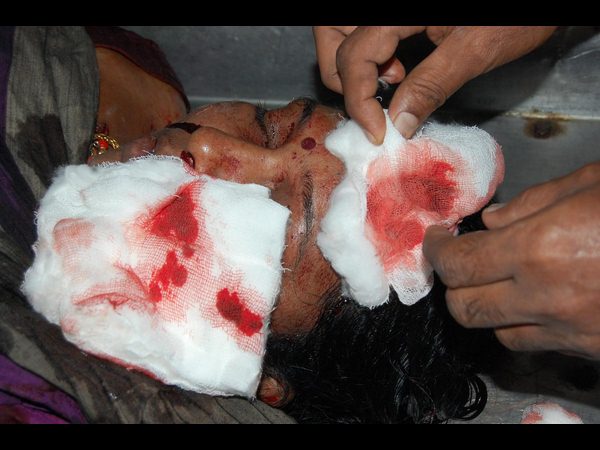 తలలో బుల్లెట్లు