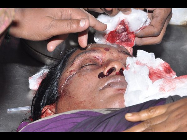 అనురాధ మృతదేహం