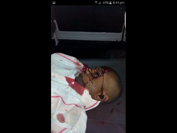 అదుపు తప్పిన కారు...