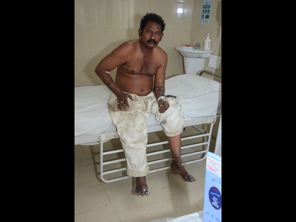 నేవీ ఆయుధాగారంలో పేలుడు: గాయపడ్డ వారు వీరే