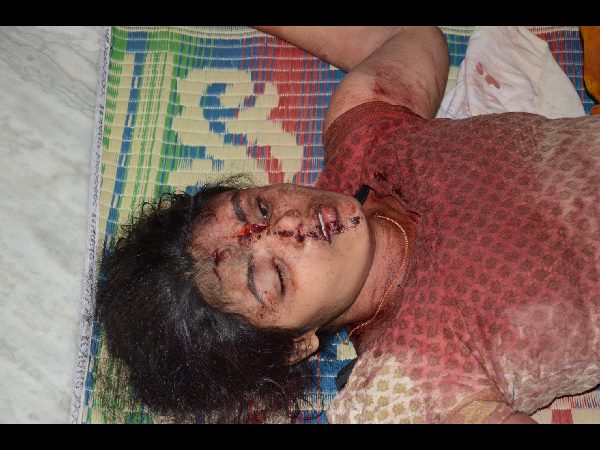 తలకు తీవ్రమైన గాయం..