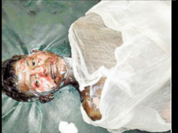 A boy allegedly burnt alive A boy allegedly burnt alive