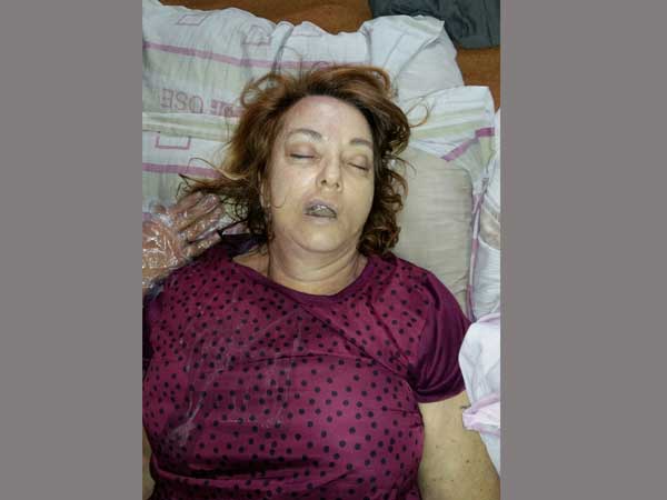 Reason behind Australian woman death in Hyderabad