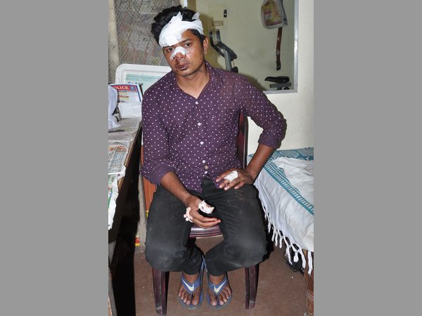 దాడి జరిగిన తర్వాత..