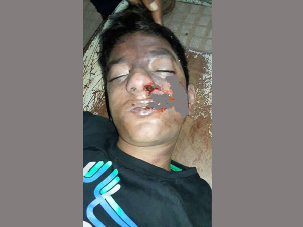 ముక్కులో పేపర్లు కుక్కి... ముక్కులో పేపర్లు కుక్కి...