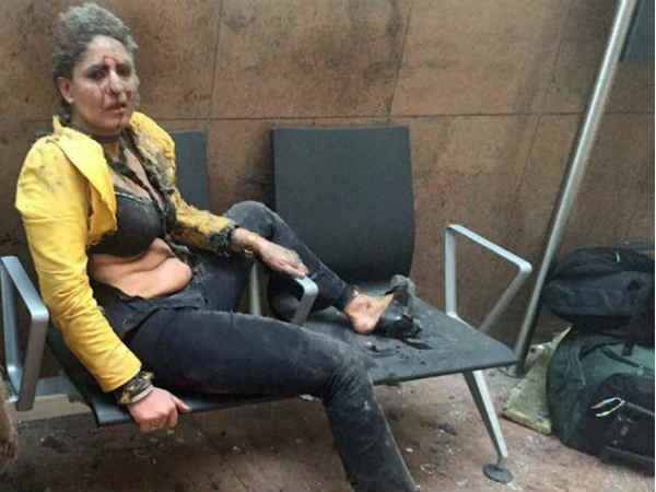 Brussels attack: Jet Airways staffer in medically induced coma, says Airline manager Brussels attack: Jet Airways staffer in medically induced coma, says Airline manager