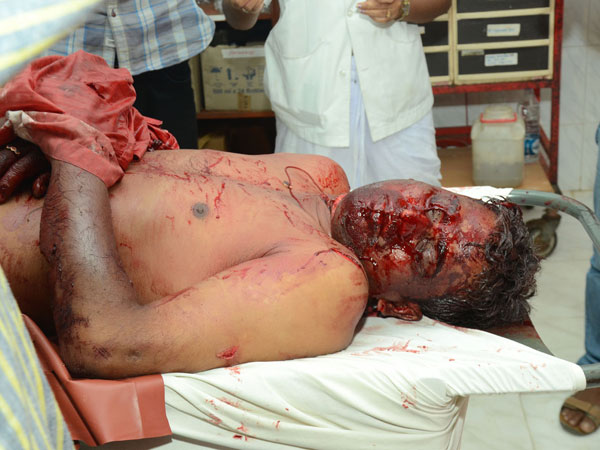 ఏలూరులో లాయర్‌ని కత్తులతో నరికి చంపిన దుండగులు 