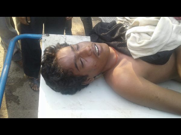  Man dies in Hyderabad zoo park