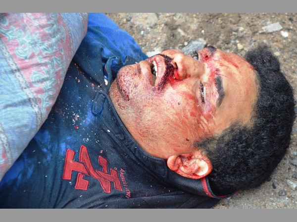 కారుపై పడిన మరో కారు, టెక్కీ మృతి