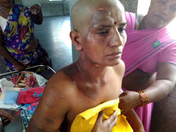 చికిత్స పొందుతున్న బాధితురాలు