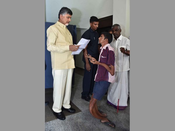 చంద్రబాబు భరోసా: ఆ చిన్నారి ప్రాణాన్ని నిలబెట్టింది చంద్రబాబు భరోసా: ఆ చిన్నారి ప్రాణాన్ని నిలబెట్టింది