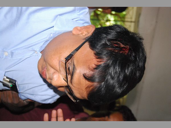 వినోద్ కుమార్ కు గాయం : 