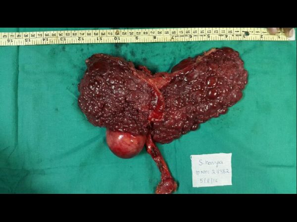  జీవితాంతం రుణపడి ఉంటాం: కావ్య తండ్రి శ్రీనివాస్