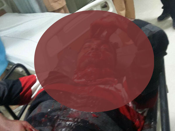 ఆస్పత్రిలో మిత్రా