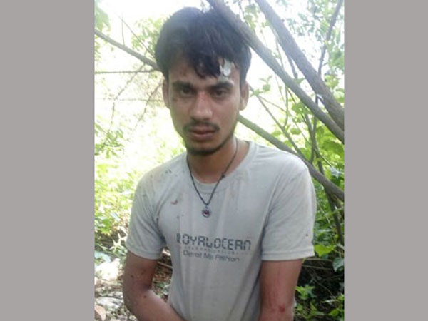 Hyderabad: Youth on drugs kills, rapes pregnant dog Hyderabad: Youth on drugs kills, rapes pregnant dog