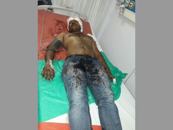 ఇష్టం లేకే..