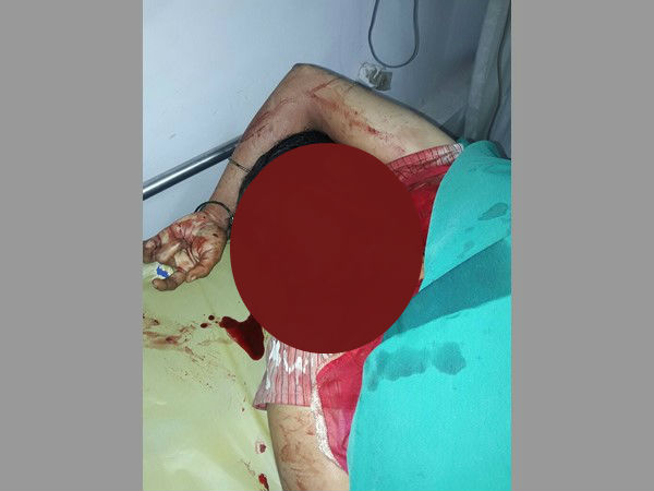 గొంతుకోశాడు