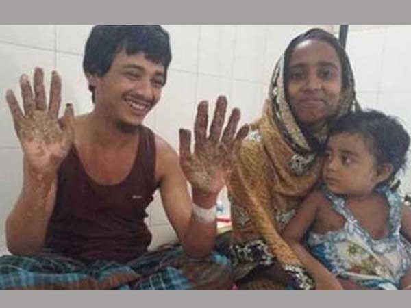 16 Surgeries for Tree Man In A Year