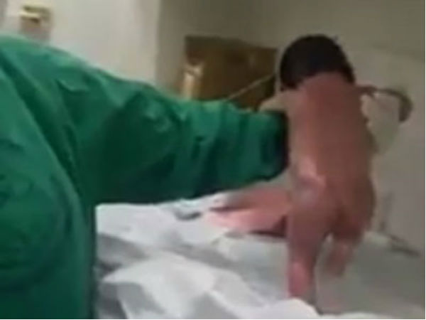 Amazing Baby.. After birth walking on hospital bed with the help of a doctor's hand Amazing Baby.. After birth walking on hospital bed with the help of a doctor's hand