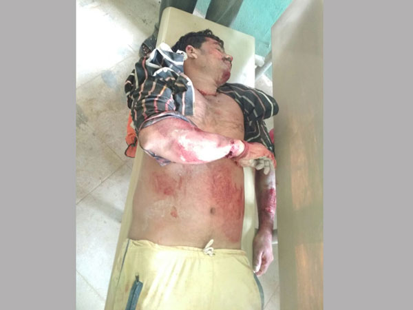 ఉన్నపళంగా కూలిపడిన బండరాయి