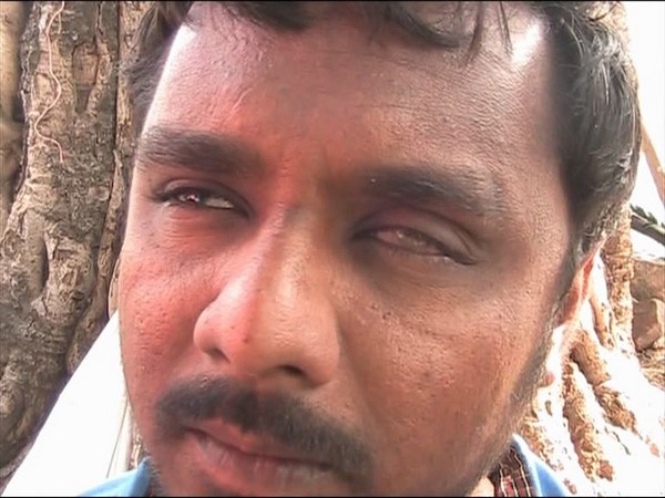 చూపులేకున్నా కాలినడకన
