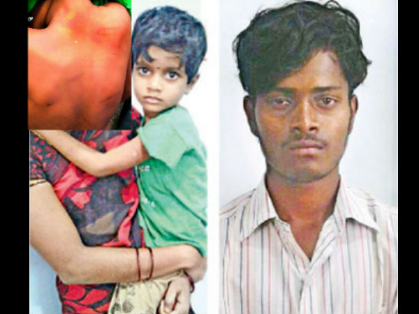 Hyderabad: 6-year-old girl brutally beaten up by mother’s lover Hyderabad: 6-year-old girl brutally beaten up by mother’s lover