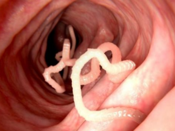 కారణమదే: