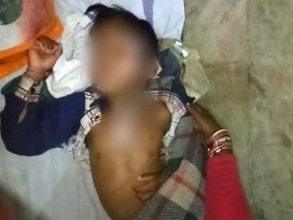 School Cook Allegedly Throws Hot Dal On Class 1 Boy Who Asked For More School Cook Allegedly Throws Hot Dal On Class 1 Boy Who Asked For More