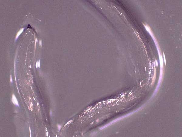  20 రోజుల్లో 14 పురుగులు...