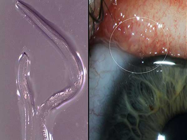  చరిత్రలోనే తొలిసారిగా బెక్లీ కంట్లో....