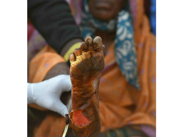 వట్టి కాళ్లతోనే నడిచారు..: