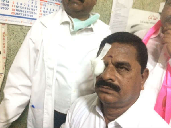 కాంగ్రెసు సెల్ఫ్ గోల్