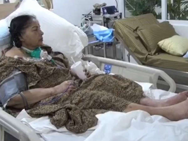 కాళ్లు తొలగించారా !