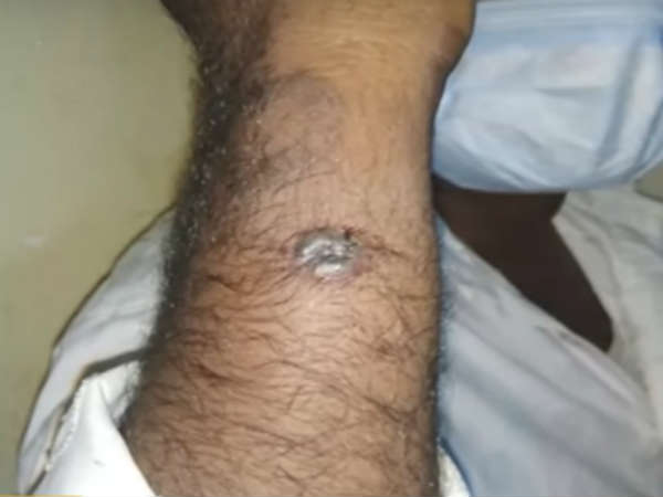 తాజాగా...15 కేసులు...ఒకేసారి