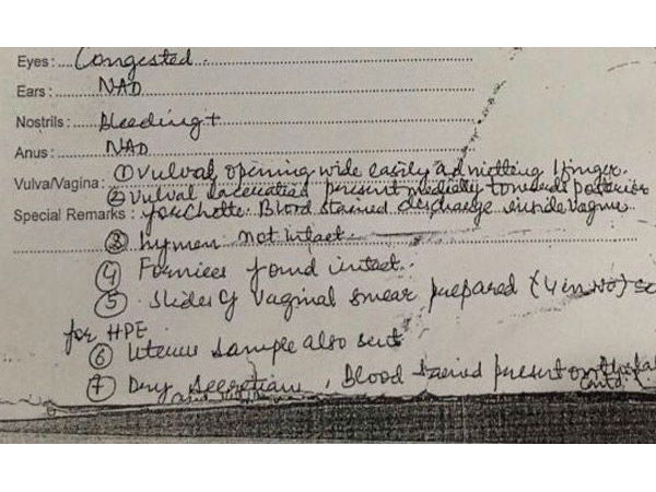 Kathua gangrape victims post-mortem reveals shocking brutality Kathua gangrape victims post-mortem reveals shocking brutality