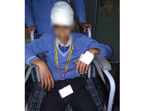 J&K: Stone-pelters attack school bus in Shopian, 2 students hurt J&K: Stone-pelters attack school bus in Shopian, 2 students hurt