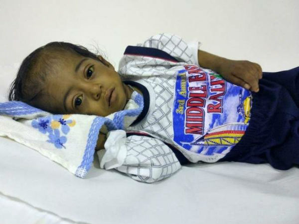 This boy cannt live without surgery