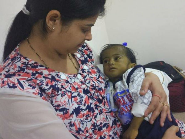 This boy cannt live without surgery