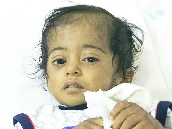 This boy cannt live without surgery