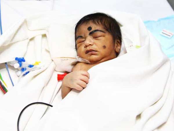 A mother’s struggle to keep her newborn son’s heart beating