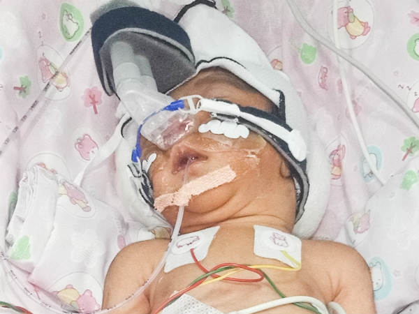 Drivers premature baby girl waits for treatment in NICU Drivers premature baby girl waits for treatment in NICU