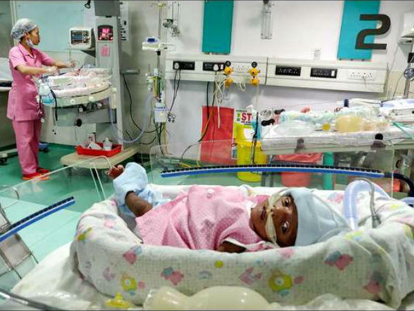 30 days girl child born prematurely and on ventilator