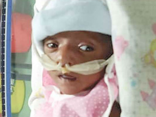 30 days girl child born prematurely and on ventilator