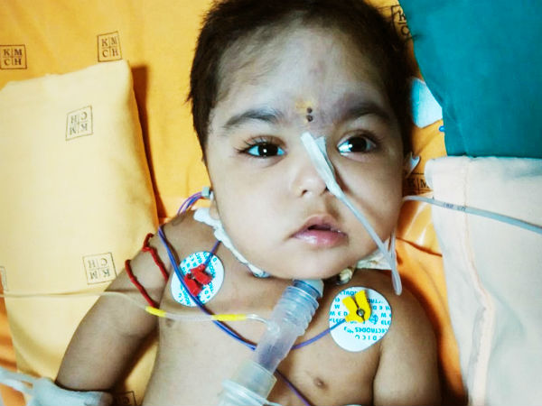 Even after 3 surgeries, this 1-year-old struggles for each breath