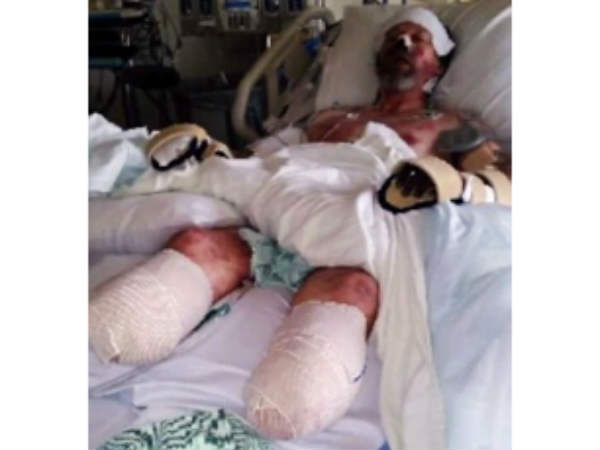 మనిషి రక్తాన్ని విషం చేయగల బ్యాక్టీరియా