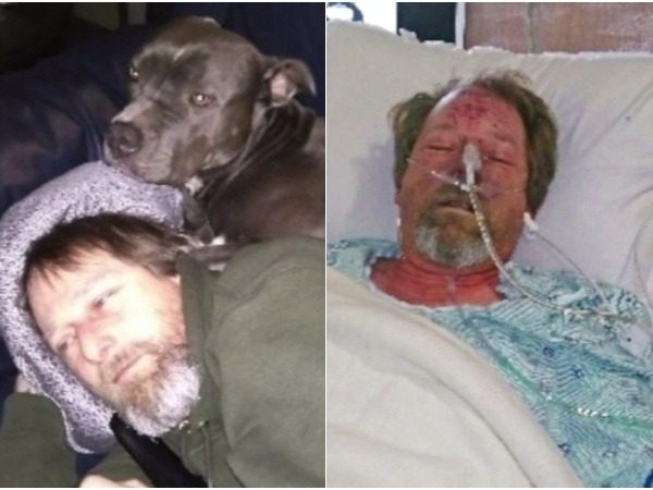 ముందుగా జ్వరం ఆతర్వాత..శరీరంపై రక్తపు గాయాలు