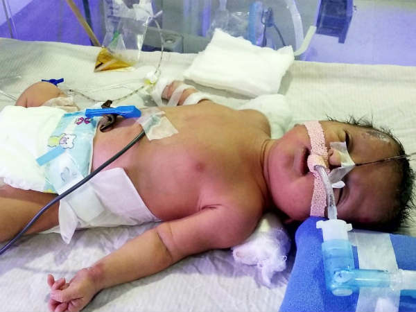 Help baby of Lakshmi, who is unhelathy. Help Lakshmi to save her newborn.