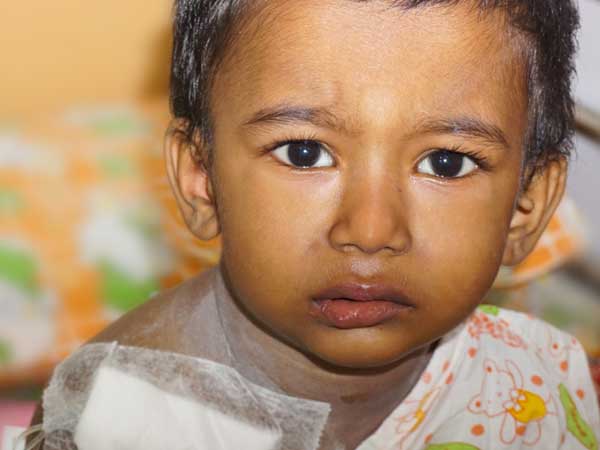  3 year old Avijit Who Suffers From Cancer Will Not Survive Without Urgent Treatment