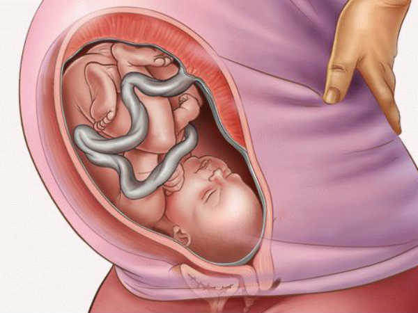 బిడ్డ కడుపులో ఉండగానే అలర్జీ